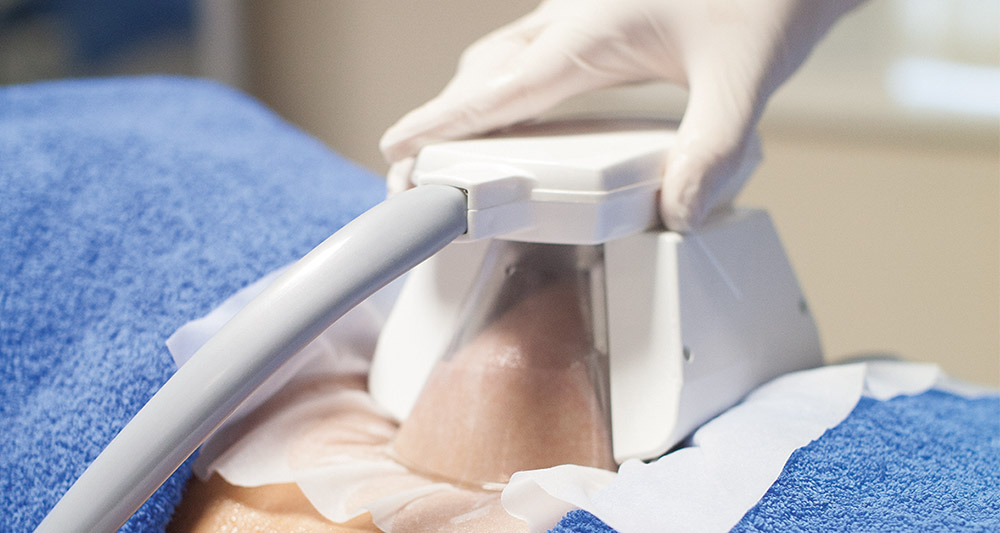 How Fat Freezing and HIFU Work Together? 2 Multiple Areas in One Session HIFU and Fat Freezing Doancaster