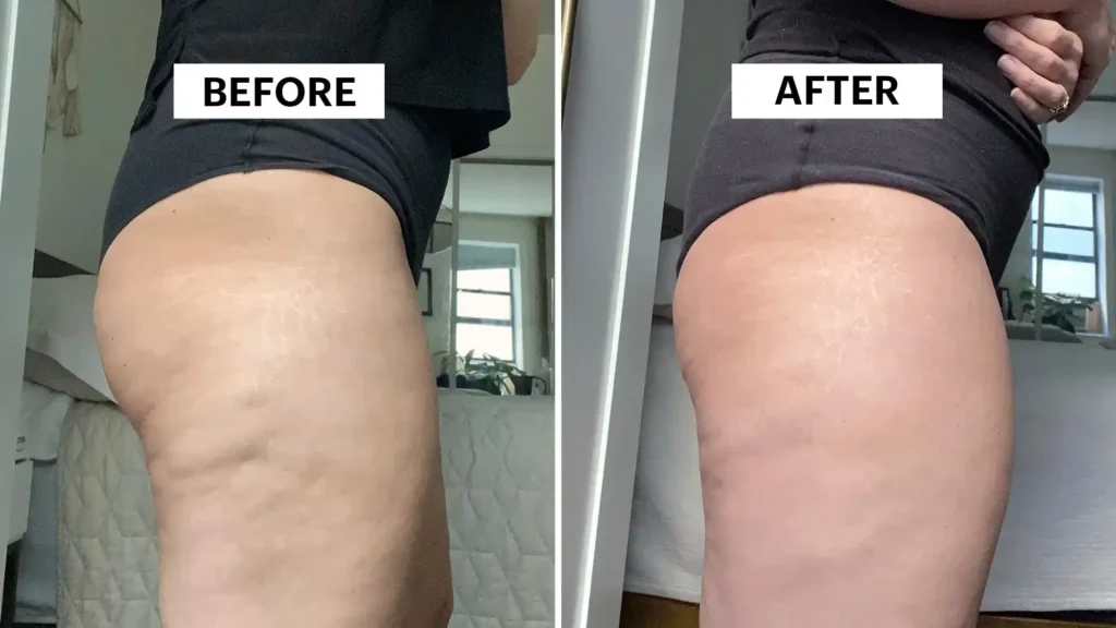 Do Toning Exercise Doancaster Really Tackle Cellulite?