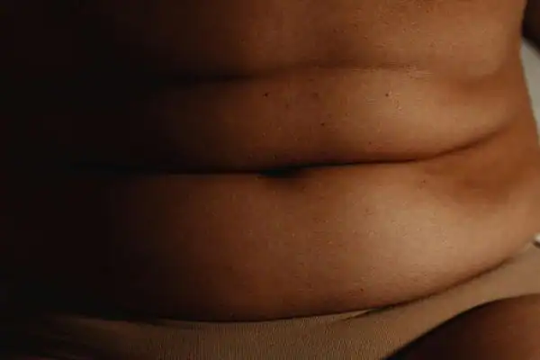 The Hidden Connection: How Stress Shapes Your Fitness and Body Composition 3 image of what stress can do on the stomach area and how Lipo 360 Doancaster can help to change your body shape.
